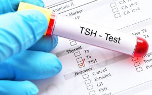 TSH teszt pajzsmirigy betegségek